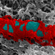 Illustration for article titled Our cells lock up Shigella bacteria in cages to stop it from killing us